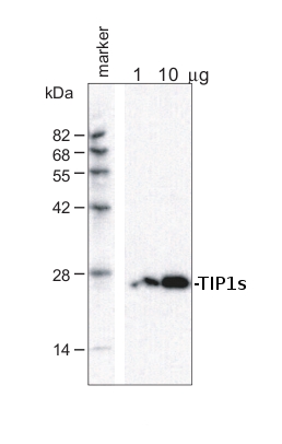 western blot using anti-TIP1s antibodies 